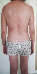 Body Type Two (BT2), Body Type Quiz/Test (Female/Women/Woman) Results 1126 - Fellow One Research, The Four Body Types