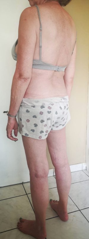 Body Type Test (Quiz) Results 1126 – Body Type Two (BT2) Female (Woman), Baby Boomer