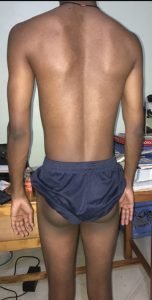 Body Type Quiz (Male/Men/Man) Results 1148, Fellow One Research - The Four (4) Body Types Test, Body Type One (BT1)