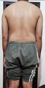 Fellow One Research, The Four Body Types Quiz - Body Type Two (BT2), Body Type Test (Man/Men/Male) Results 1230