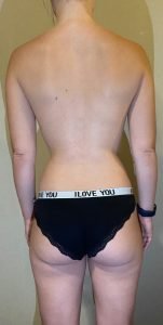 The Four Body Types Quiz, Body Type Test (Woman/Women/Female) Results 1245 - Body Type Two (BT2), Fellow One Research,