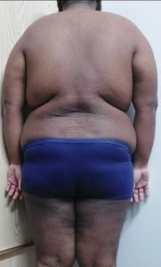 The Four Body Types Quiz, Body Type Test Man/Male/Men Results 1303 - Body Type Four (BT4), Fellow One Research