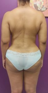 The Four Body Types Quiz, Body Type Test Woman/Female/Women Results 1410 - Body Type Three (BT3), Fellow One Research