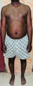 Body Type Test Male/Man Results 1443, Fellow One Research - The Four (4) Body Types Quiz, Body Type Three (BT3)